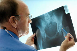 Orthopaedic Doctors Analysing Patient x-ray
