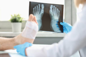 doctor reviewing xray after foot surgery