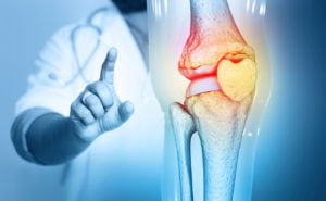 Bone Doctor check and diagnose the Pain in knee joint on medical background