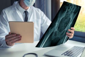 Preoperative Planning in Hip Surgery